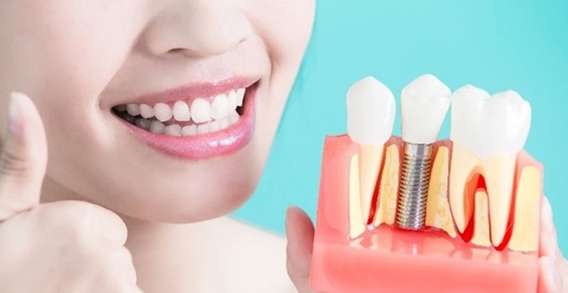 Dental Treatment & Implant